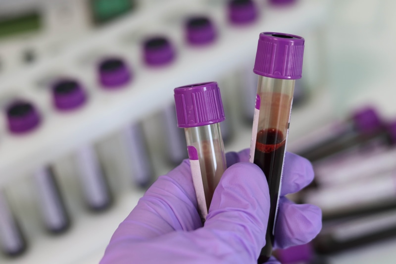 pink color, scientist, medicine, medical research, selective focus, lab, 5K, focus on foreground, medical, research, test tube, technician, equipment