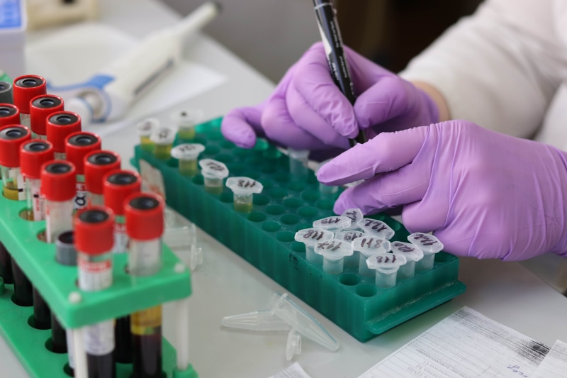 test tube rack, one person, lab, experiment, equipment, research lab, woman, person, health, human hand, hand, tube, skill, laboratory, healthcare, 5K