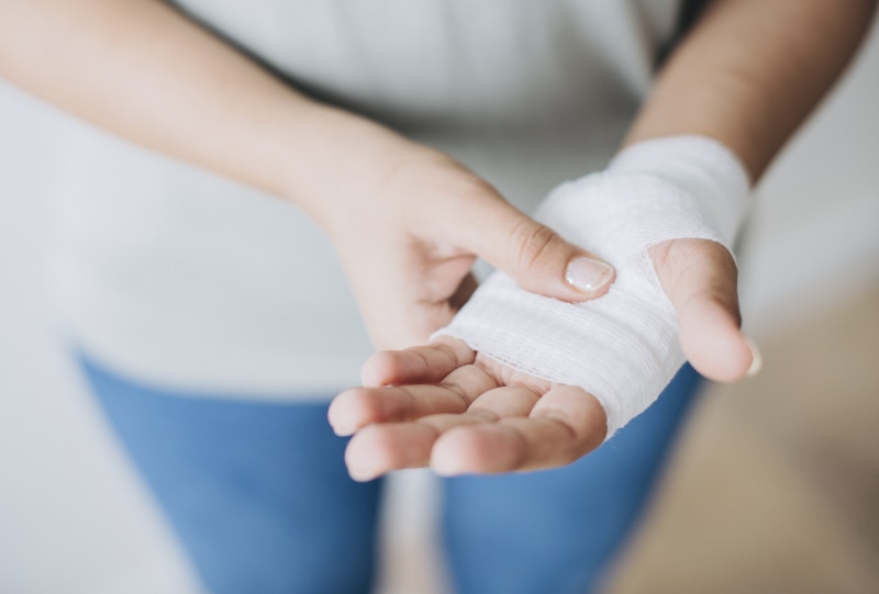 limb, treatment, skin, human arm, wrist, human, healthcare and medicine, white, body part, care, holding, human limb, adult, physical injury, bandage, pain