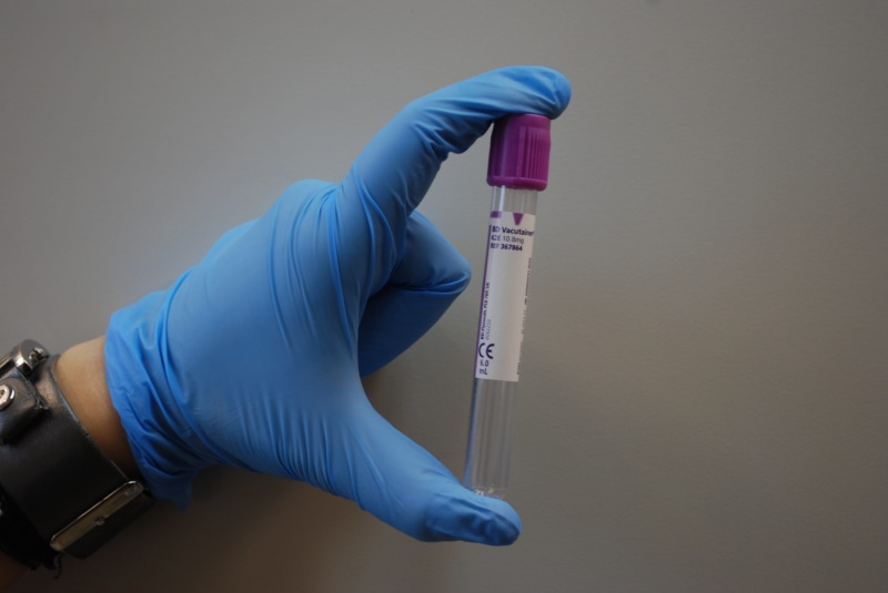 research, healthcare worker, blood, studio shot, healthy lifestyle, lab, accuracy, glove, medicine, real people, care, one person, medic, side view, human body part