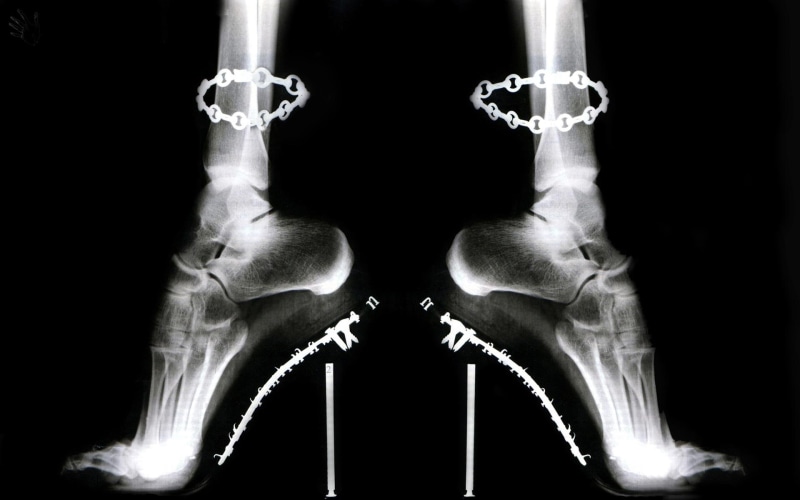 3d and abstract, stilettos, shoes, 1080P, cruel, x ray foot, black and white, entropy, not walking shoes