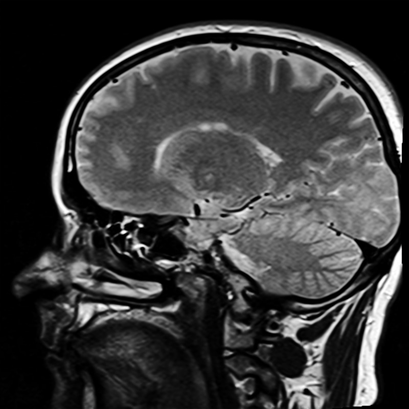 human, biology, human representation, x, x ray, head, 1080P, medical exam, bone, healthcare and medicine, medical x-ray, x ray image, representation, black background