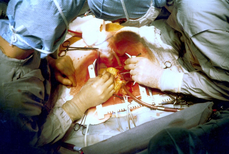 cooperation, occupation, human hand, surgical glove, blood, surgical equipment, 1080P, medical, indoors, theater, hand, people, responsibility, adult