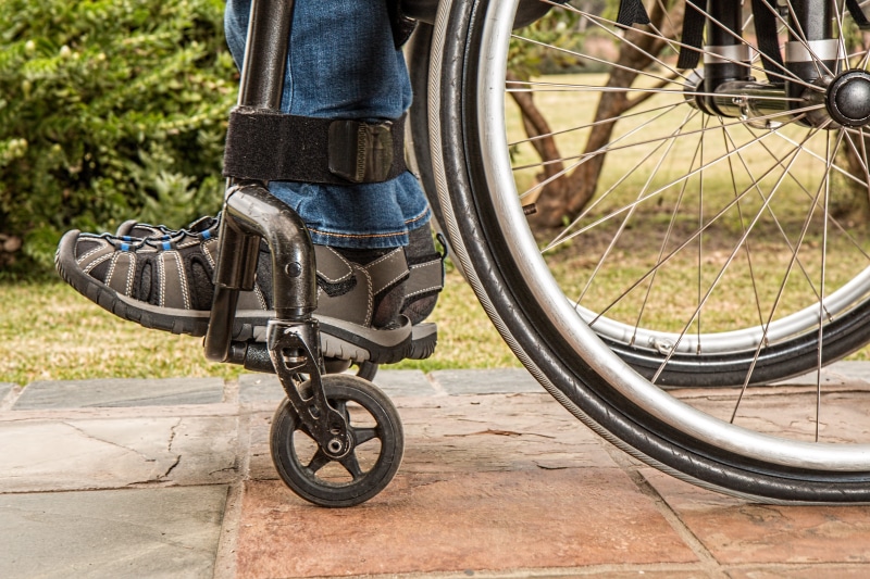 human leg, human body part, gray, land vehicle, human foot, medical, treatment, disability, rehabilitation, wheelchair, accident, wheeled, cycling, men