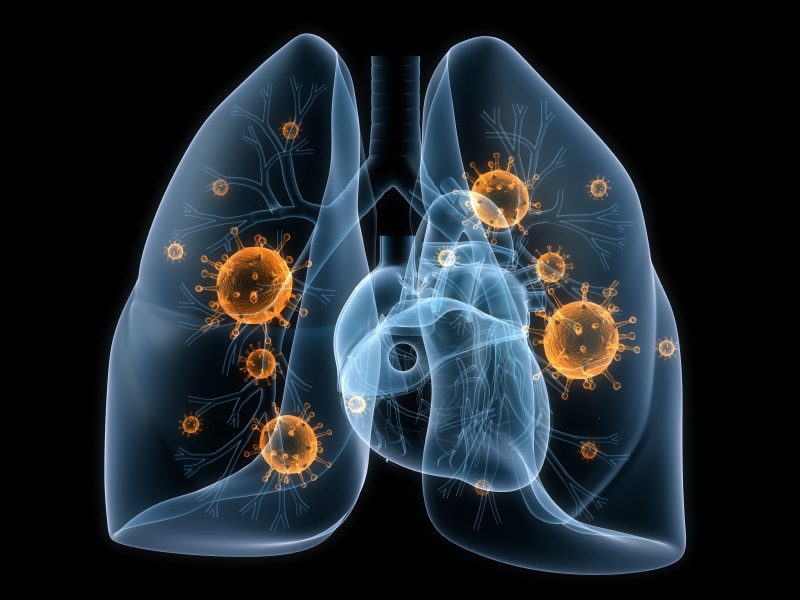 disease, viruses, 4K, lungs, bacteria