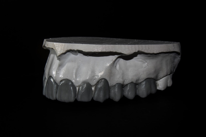 black background, studio shot, dental equipment, people, artificial, mouth, model, equipment, dentistry, 5K, still life, clinical, denture, clinic, hygiene