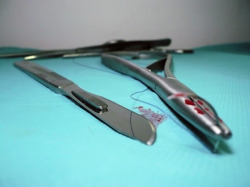 scissors, surgical equipment, the patient, photography, table, scalpel, forceps, intervention, indoors, surgery, the doctor, hospital, 2K, still life