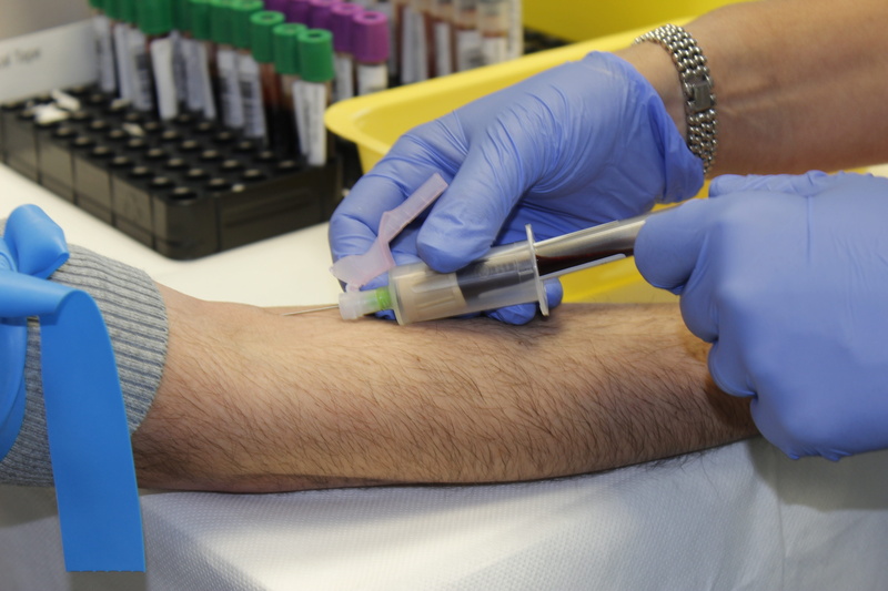 healthcare and medicine, 5K, life, pain, real people, surgical glove, pharmacist, analyzing, protective glove, withdrawal, tubes, glove, syringe, italy