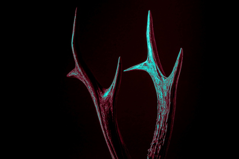 beige, antler, motion, bone, colored background, mri scan, human body part, red, black background, people, x-ray image, sharp, shape, tomography, hospital