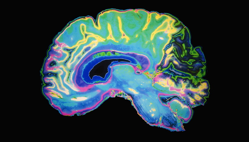4K, studio shot, anatomy, biology, medical exam, mri scan, close-up, medical x-ray, black background, science, healthcare and medicine, X rays, animal