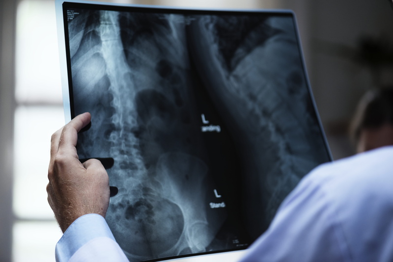 human body part, x, expertise, hospital, human bone, analyzing, backbone, technology, 5K, spines, people, modern, adult, hand, radiology, doctor, occupation