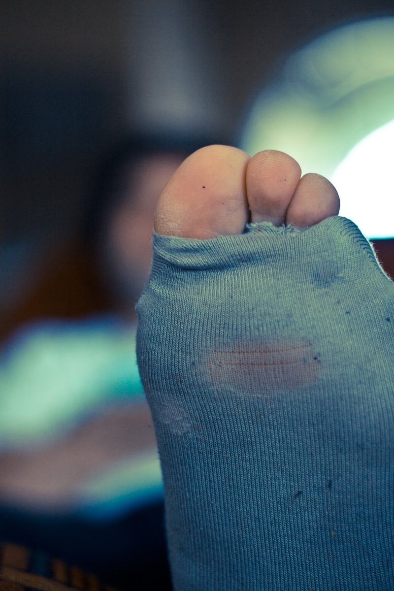 child, human leg, wearing, one person, hand, toes, holes, lifestyles, gray, toe, 2K, finger, physical injury, bandage, human hand, day, foot, person, real people