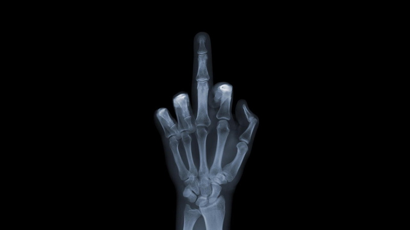 ray, illness, white, isolated, 1080P, hospital, illustration, x, the, surgery, medicine, copy space, aggression, studio shot, bones, science