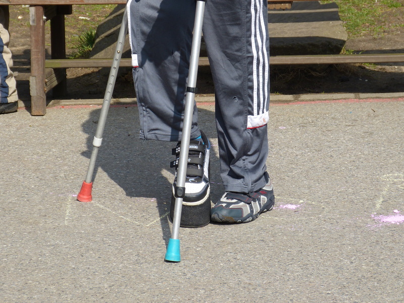 human leg, day, crutch, shadow, human limb, body part, using, forearm, physical impairment, person, handicap, human body part, sunlight, real people, 4K