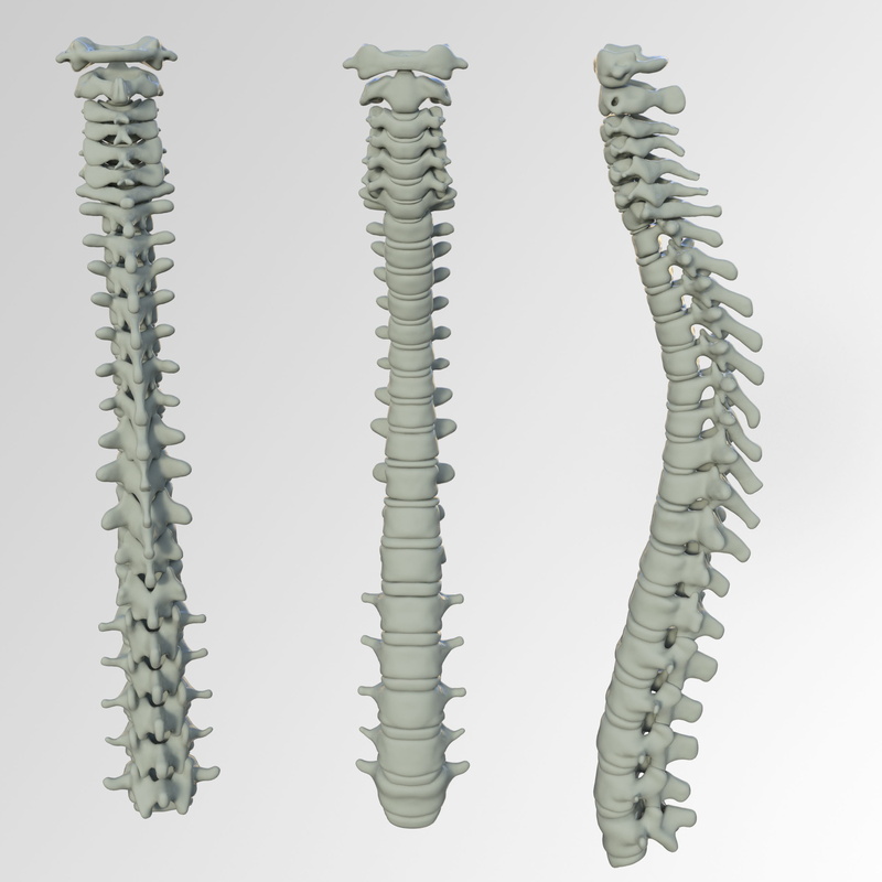 backache, spinal, in a row, studio shot, vertebrae, pattern, metal, spiral, nature, move, collage, collection, high angle view, lumbar disc herniation