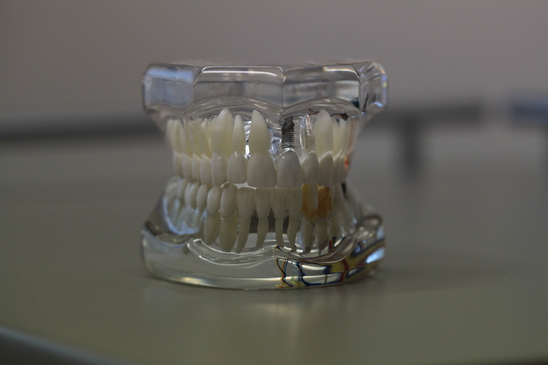 close-up, science, indoors, glass, food and drink, healthcare, black background, Dentals, Jaw, glass - material, tooth, care, household equipment, focus on foreground