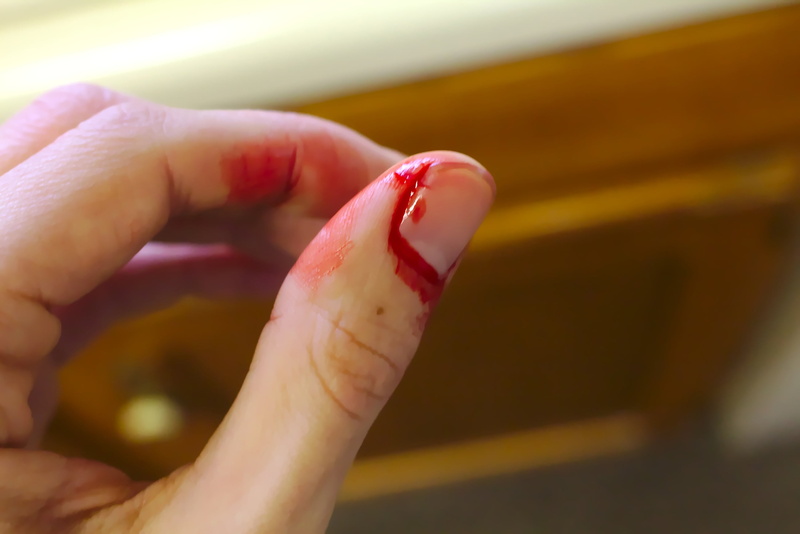 medical, injury, human Finger, one person, limb, holding, emergency, photography, knife, health care, injured, bleeding finger, 2K, wound, nail, cut, hurt