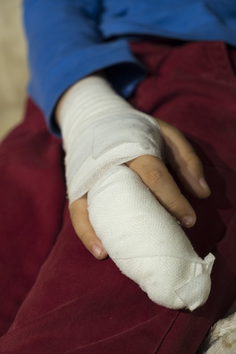 wound, physical injury, boy, limb, nurse, association, human body part, white, healthcare and medicine, 5K, care, hand, pain, misfortune, finger, bandages