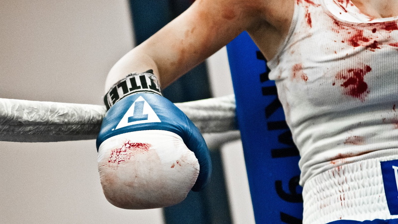 close-up, limb, midsection, day, pain, body part, sport, standing, Boxing, human body part, hand, wound, Sports, indoors, physical injury, focus on foreground