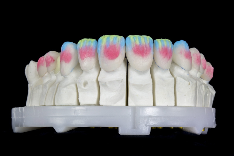 group of objects, ivoclar vivadent, style, food, in a row, close-up, prosthesis, snack, large group of objects, studio shot, dieting, die, contact lenses