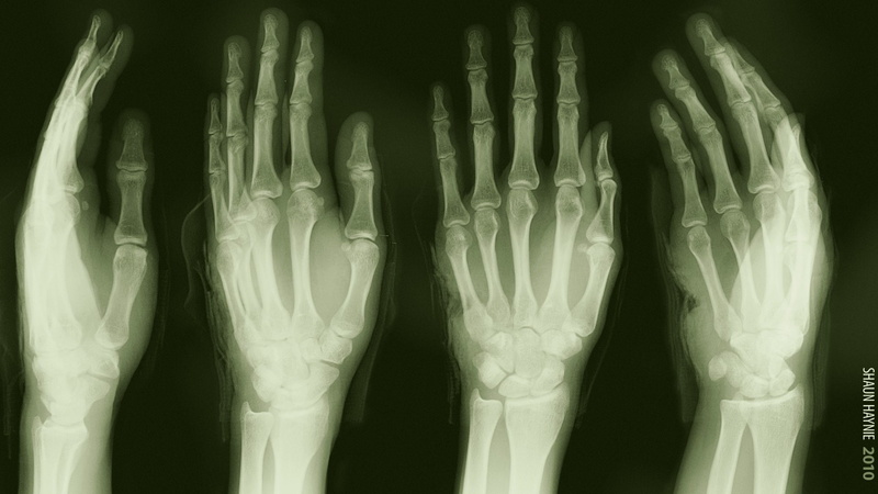 1080P, bones, Hand, X-Ray, human, illustration, Medical, Dark, Skeleton, Green