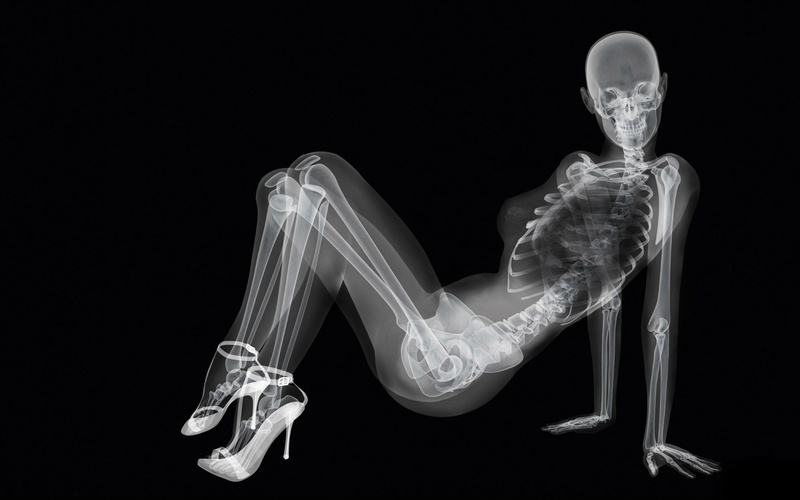 1080P, human Leg, ray, creativity, bone, healthcare And Medicine, representation, illuminated, no people, x-ray Image, black Background, design, digital composite