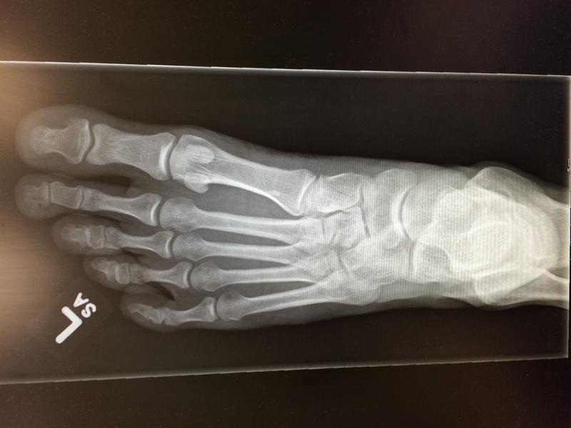 wrist, 1286 durant dr, x-ray image, body part, human joint, human bone, finger, human body part, hand, limb, anatomy, medical exam, human limb, people