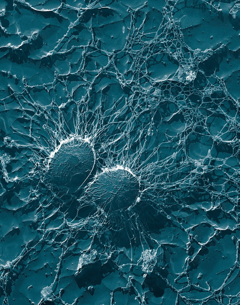 backgrounds, pattern, vaccination, risk, high angle view, pathogens, abstract, 720P, staphylococcus, electron micrograph, decor, teal, purity, white, white color