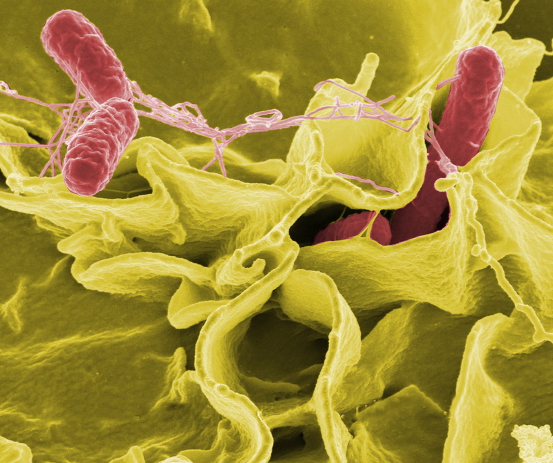 photography, enterobacteriaceae, biology, disease, wellbeing, 1080P, bacterium, view, microorganism, escherichia, electron micrograph, food, red, coliform
