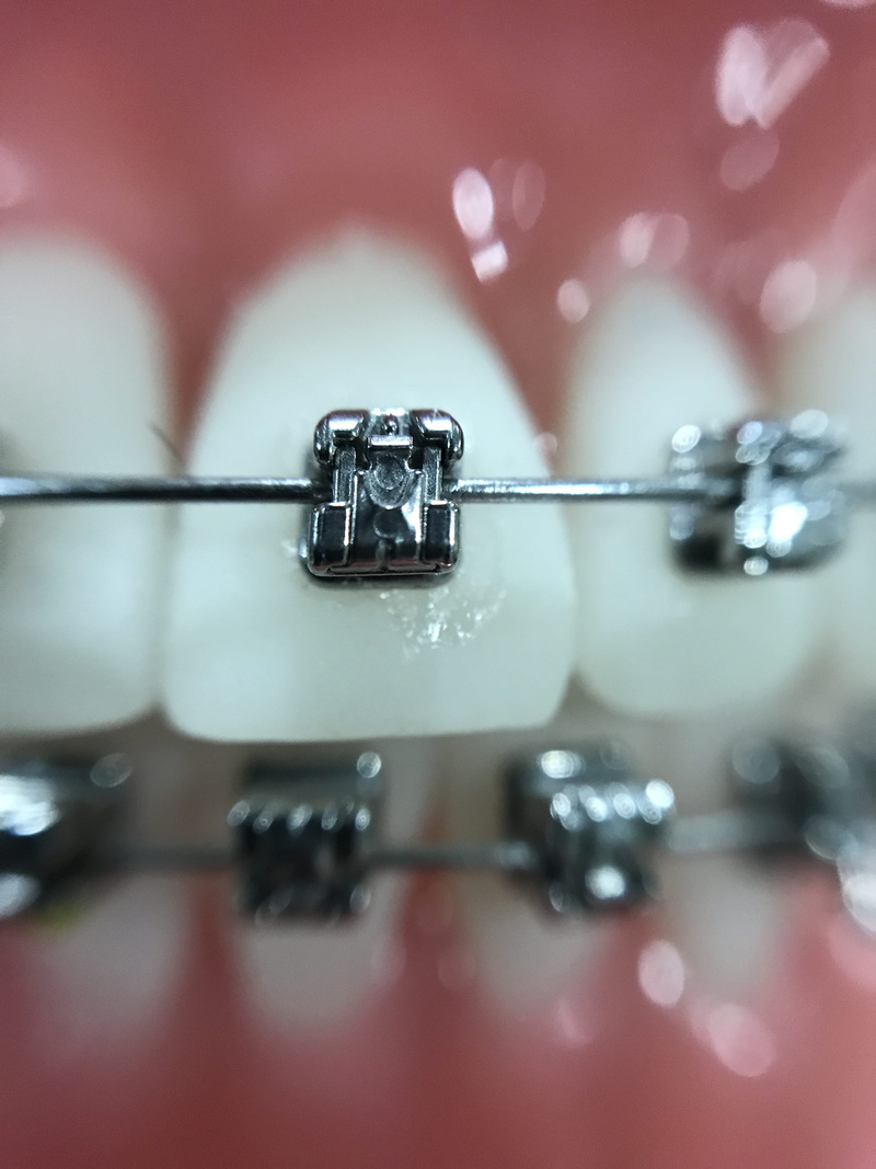 guitar, Orthodontics, Iphone, table, silver, hanging, focus on foreground, teeth, still life, wet, 4K, metal, close-up, selective focus, red, silver colored