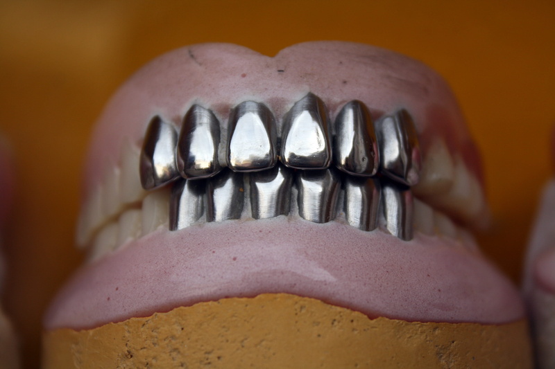 indoors, orthodontic, close-up, colored background, mouth, 4K, body part, dentures, human teeth, bone, metal teeth, Teeth, Dental, Metal, oral, healthcare and medicine
