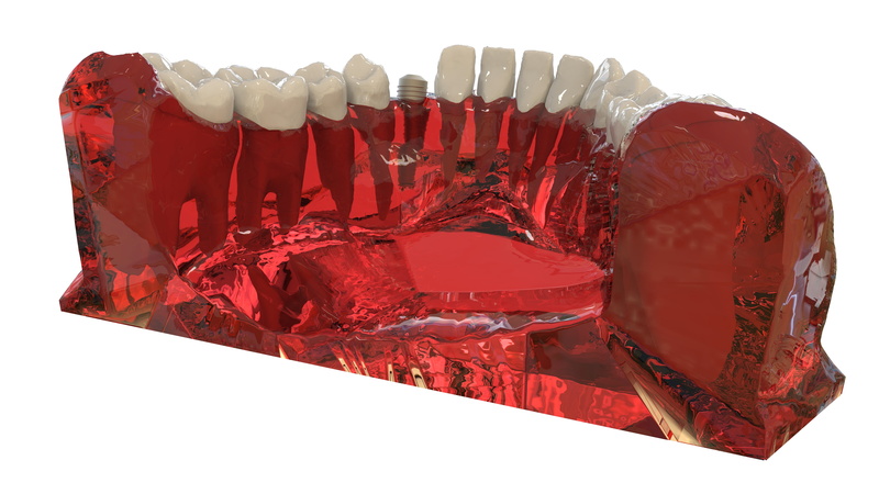 white background, digital composite, 3d model, red, science, no people, nature, cut out, single object, close-up, the implant, high angle view, white color