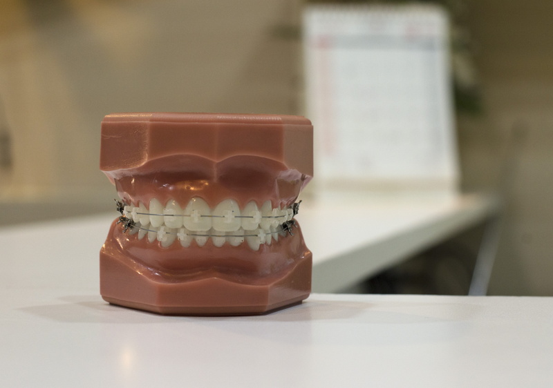 ceramic, drink, temptation, appointment, teeth, indoors, denture, household equipment, food and drink, visit, single object, tray, dentist, sweet food