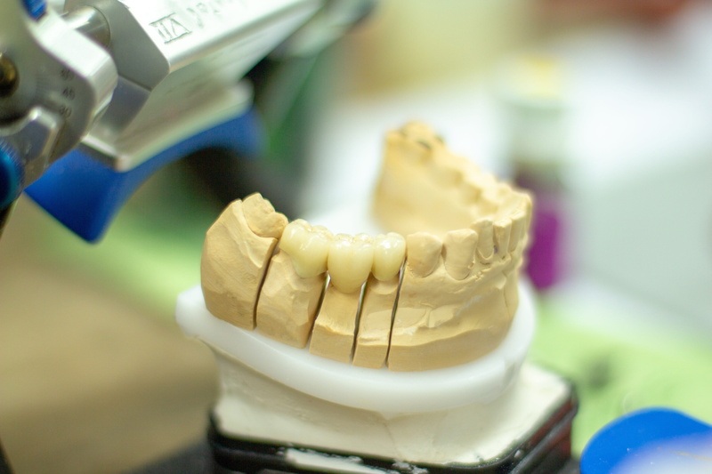 healthcare and medicine, articulator, equipment, hand labor, person, focus on foreground, pouring, smile, dentist, economy, no people, selective focus