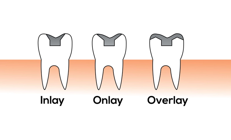 tooth, communication, illustration, studio shot, crowns, oral health, dentist, white background, indoors, message, close-up, cut out, single word, symbol