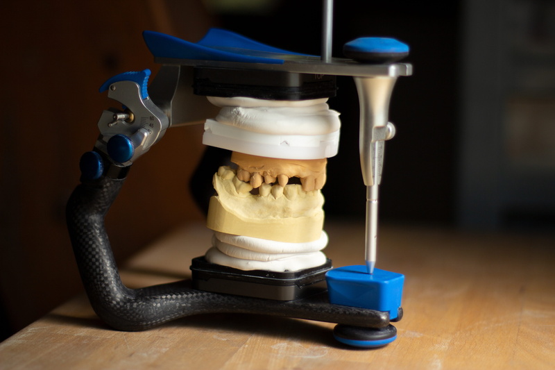 dentist, wood - material, connection, dentistry, reflection, food, still life, simplicity, healthy, articulator, 5K, toy, ceramic, person, equipment, blue