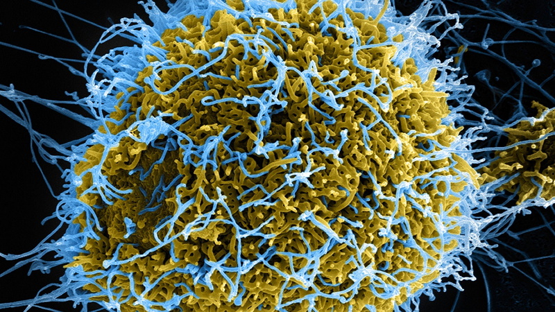 dark, 1080P, horror, ebola, virus, medical