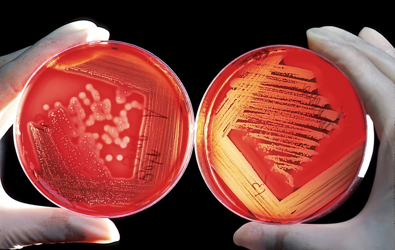cell growth, indoors, experiment, close-up, fruit, scientists, germs, finger, drink, electric lamp, japanese gelatine, japanese fish glue, holding, biology