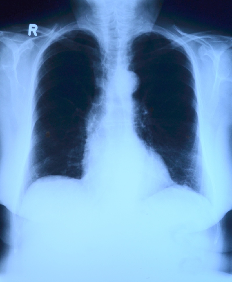 ray, radiologist, human body part, x ray, bone, front view, healthcare And Medicine, close-up, indoors, accidents and disasters, x ray image, human skeleton