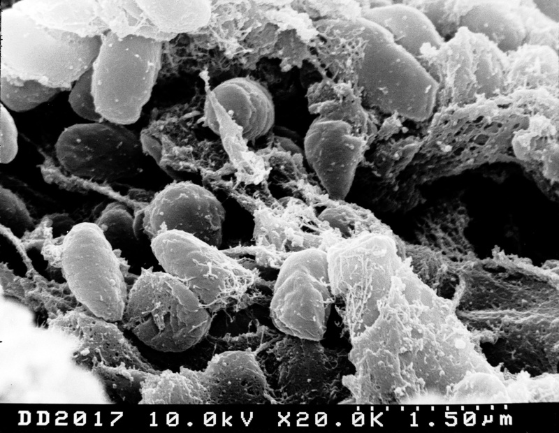 bubonic plague, bacteria, scan, microscopic, science, biology, medical, epidemic, animals in the wild, no people, pestis, growth, electron microscope, technology