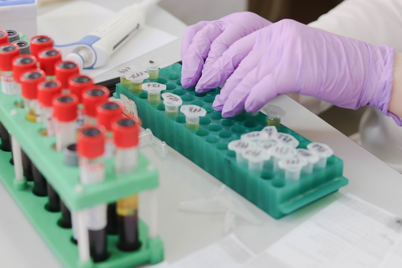 large group of objects, hand, science, 5K, equipment, indoors, blood samples, hospital, test tube rack, person, laboratory, scientist, education, medical research