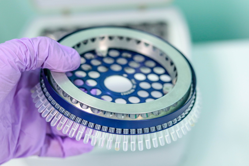 scientific method, analyzing, tubes, protective workwear, science, disease, hand, adult, one person, microscope, vial, body part, human body part, background