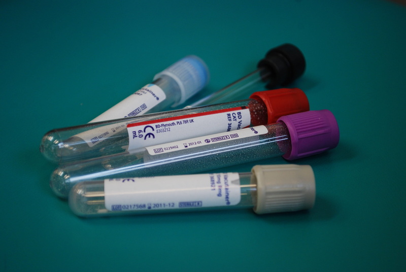 research, container, no people, glass - material, blood, five, laboratory, selective, table, diagnosis, indoors, clear, closeup, healthcare and medicine