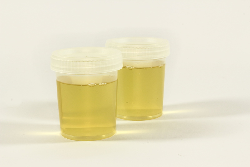healthcare And Medicine, still life, medical, food, hospital, filled, 5K, containers, two, research, medic, white background, close-up, urine container