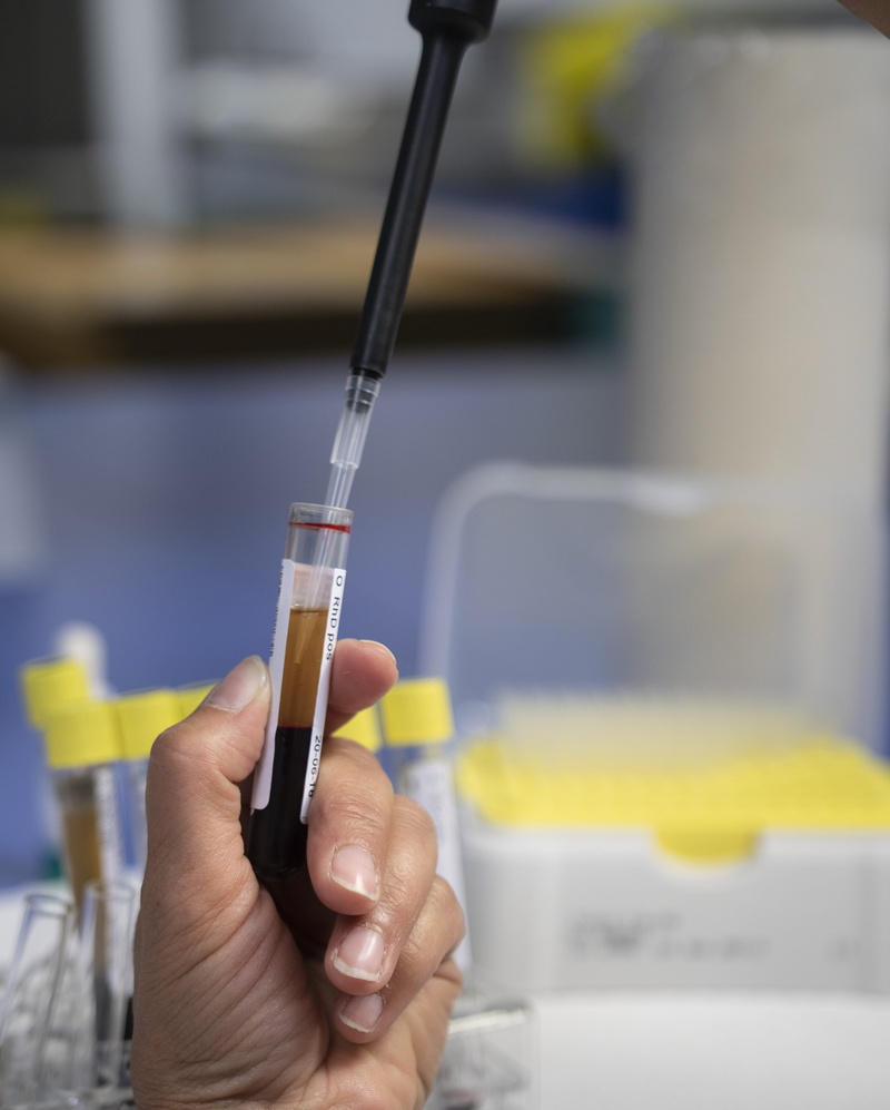 glass, unrecognizable person, scientific experiment, needle, close-up, occupation, microbiology, dental equipment, medical, diagnostics, hand, tests, diagnostician