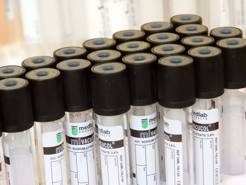 pierre was the head of the, still life, equipment, tubes vacuum, 4K, cure, bottle, analysis, the patient, tech, medical, microscope, health, science, care