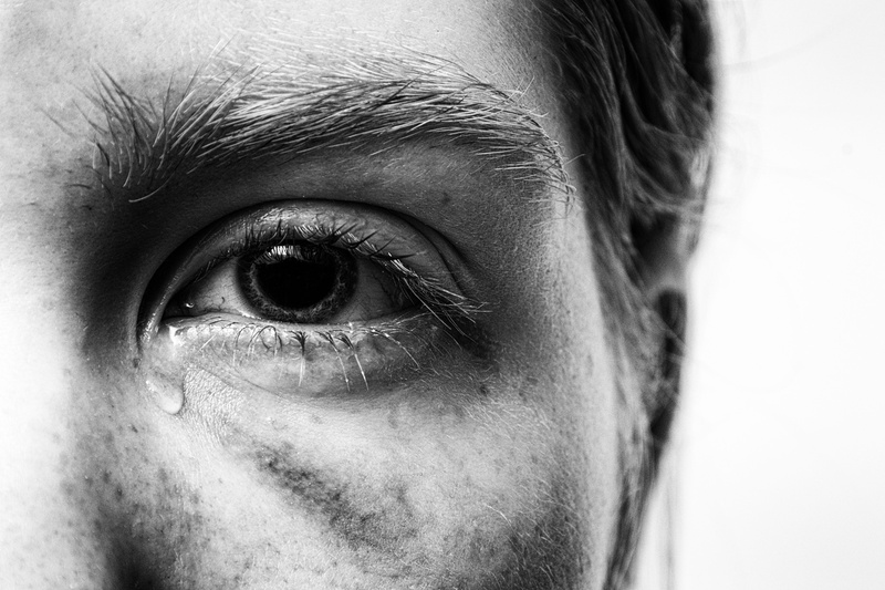 close-up, sensory perception, trauma, injury, victims, iris - eye, blue blot, real people, pain, eyelid, haematoma, eyeball, tears, adult, human hair, tormented