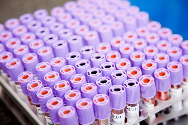 large group of objects, healthcare and medicine, blue, indoors, lab, research, blood test, biology, order, test tube, medical test, in a row, samples, technology