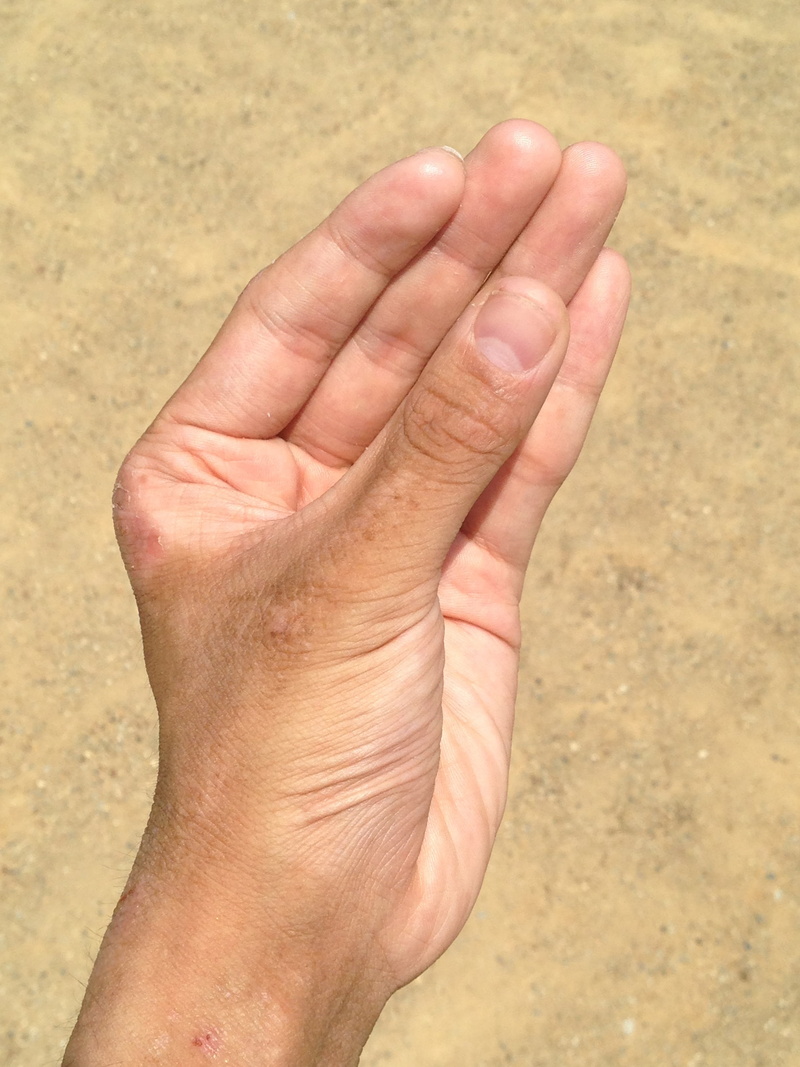 nail, power, olympic games, sandy, fortune-telling, parts, blood, human skin, kishibe, men, beach, male, memories, medical care, description, close-up