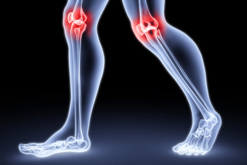 legs, knee, joint pain, 5K